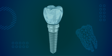 Titanium Dental Implant (implant only)